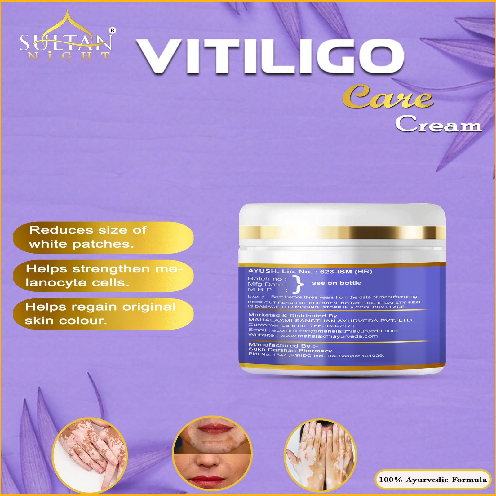 Vitiligo Care Cream Batch